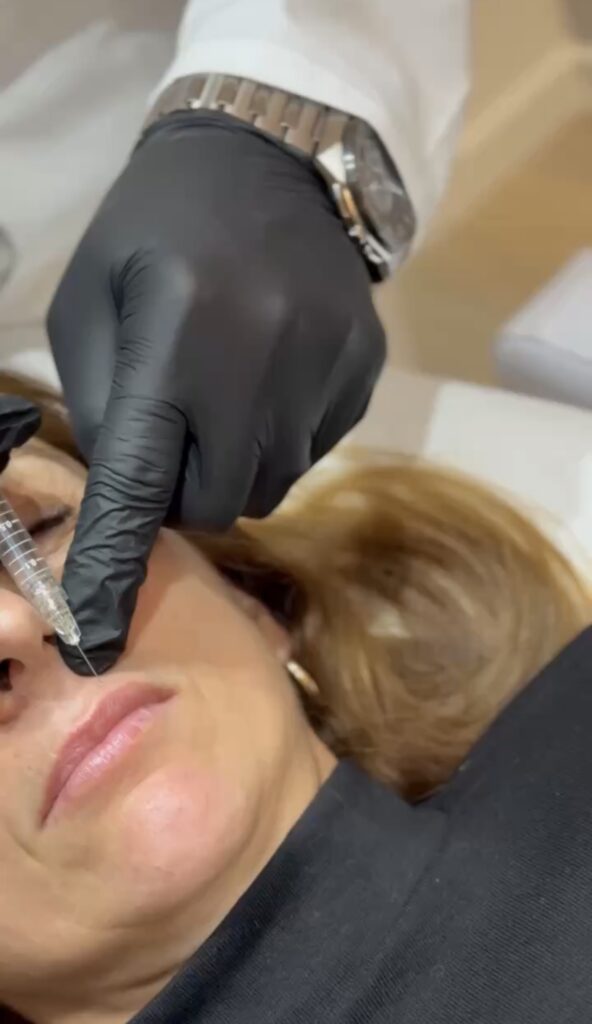 Rejuvenation, Volume and Facial Beauty Enhancement