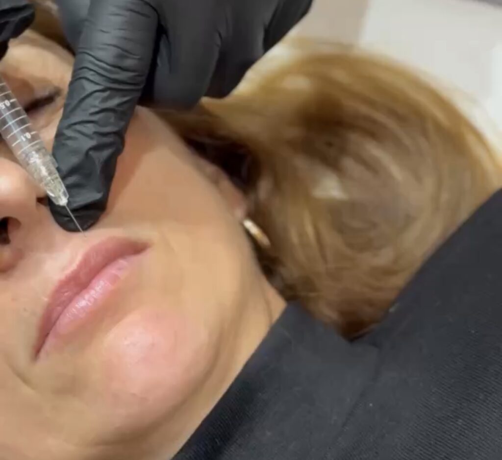 Rejuvenecimiento facial médico con resultados naturales