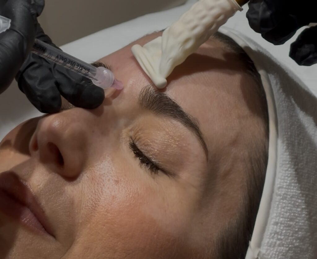 Relajación muscular precisa para un rostro más armonioso