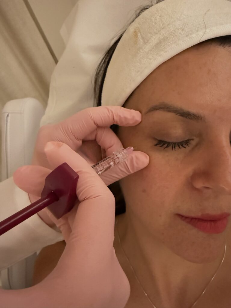 Facial Rejuvenation through Mesotherapy: Deep Nutrition and Hydration for the Skin