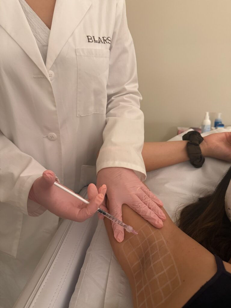 Treatment of Hyperhidrosis with Neuromodulators: Control Excessive Sweating