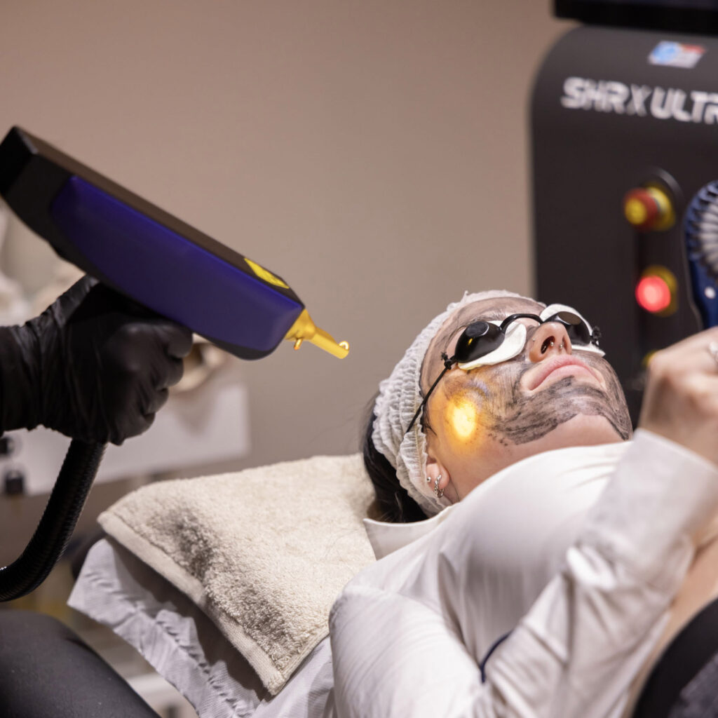 Hollywood peel: limpia, unifica y rejuvenece tu piel