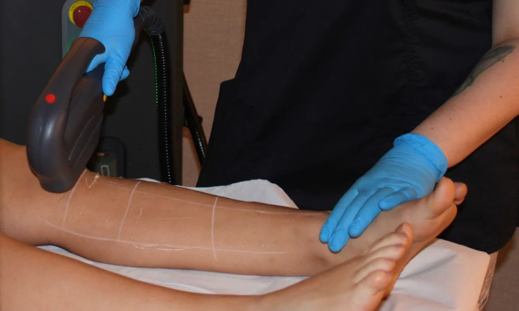 Piel más suave y sin vello de forma progresiva y duradera